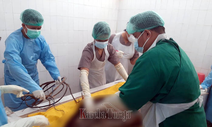 Mayat Tak Utuh yang Ditemukan di Bonggakaradeng Diautopsi